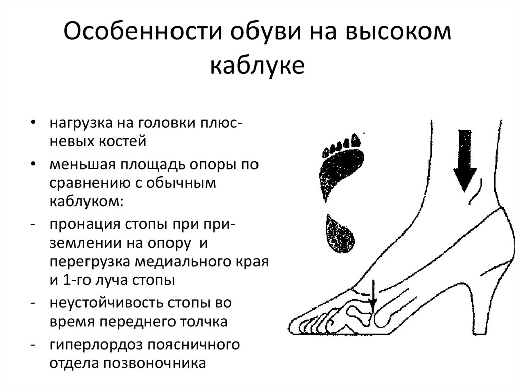 Пронация стопы. Пронация кроссовки. Нейтральная пронация стопы что это. Что такое пронация в обуви. 3 типа стопы