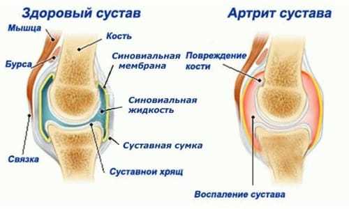 Коленный бандаж medi